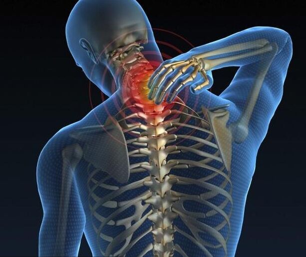 Neck bone and chondropathy