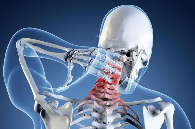 The first degree of osteocartilage